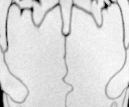 data/angustifrons_slice.png