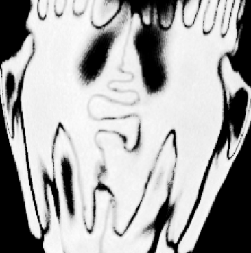 data/baika_slice.png