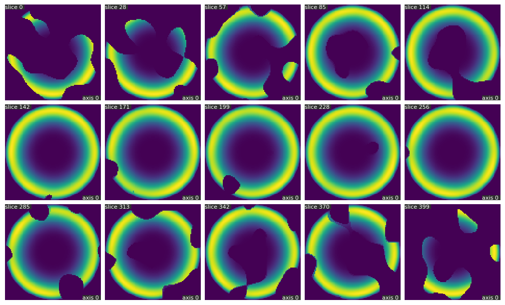 docs/assets/screenshots/synthetic_blob_tube_slice.png