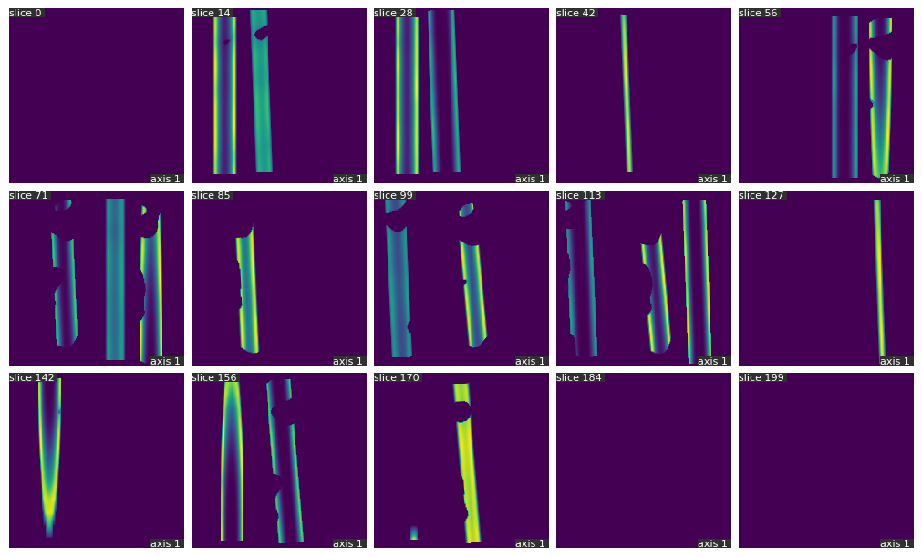 docs/assets/screenshots/synthetic_collection_tube_slices.png