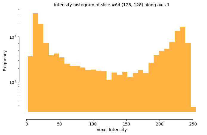 docs/assets/screenshots/viz-histogram-slice.png