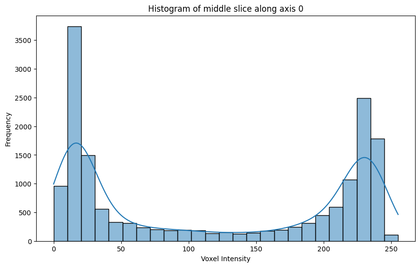 docs/assets/screenshots/viz-histogram.png
